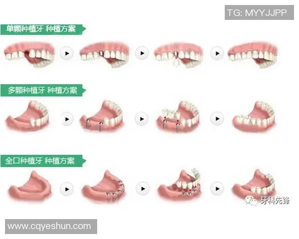 足球球星体格检查全过程揭秘及其对竞技状态的影响分析